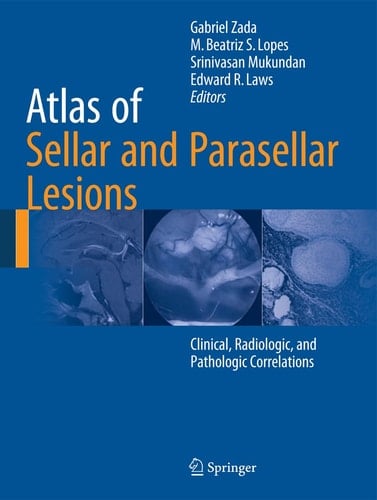Atlas of Sellar and Parasellar Lesions Clinical, Radiologic, and Pathologic Correlations