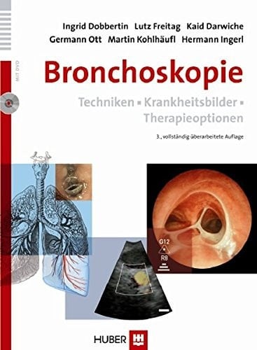 Bronchoskopie Techniken, Krankheitsbilder, Therapieoptionen