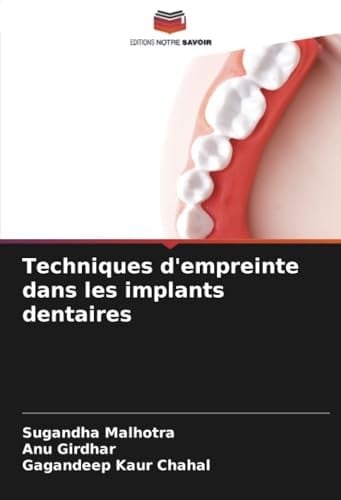 Techniques d'empreinte dans les implants dentaires (French Edition)
