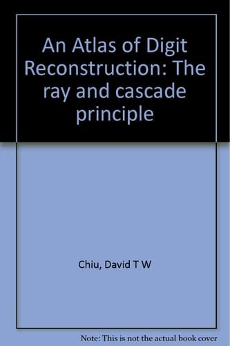 An Atlas of Digit Reconstruction: The ray and cascade principle