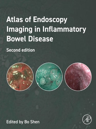 Atlas of Endoscopy Imaging in Inflammatory Bowel Disease