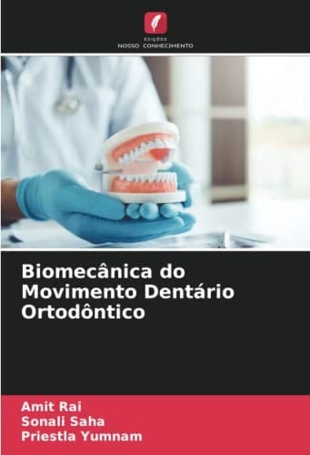 Biomecânica do Movimento Dentário Ortodôntico (Portuguese Edition)