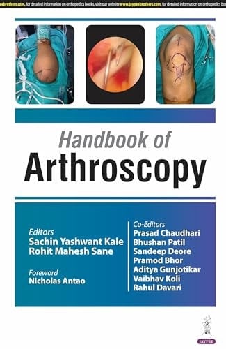 Handbook of Arthroscopy