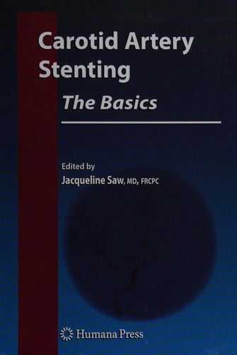 Carotid Artery Stenting: The Basics