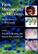 From Melanocytes to Melanoma