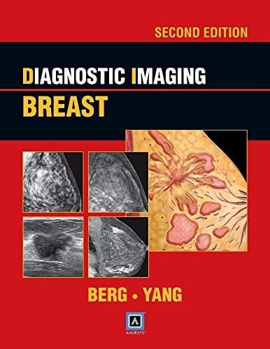 Diagnostic Imaging Breast