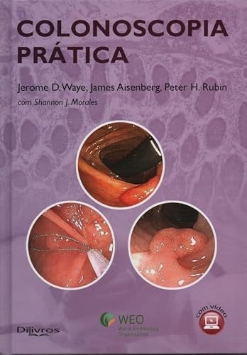 Colonoscopia Pratica