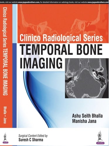 Clinico Radiological Series: Temporal Bone Imaging