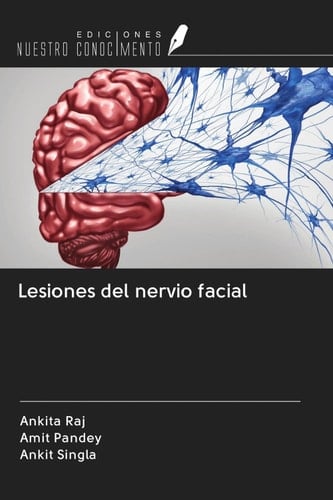 Lesiones del nervio facial (Spanish Edition)