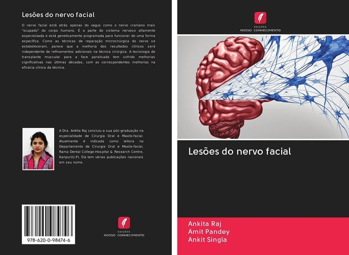 Lesões do nervo facial (Portuguese Edition)