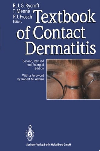 Textbook of Contact Dermatitis