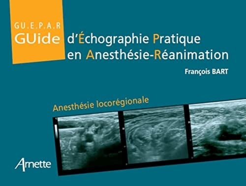 Guide d'Echographie Pratique en Anesthésie-Réanimation Anesthésie Iocorégionale