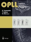 OPLL Ossification of the Posterior Longitudinal Ligament