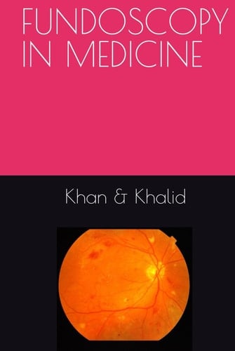 FUNDOSCOPY IN MEDICINE (PEARLS OF MEDICINE)