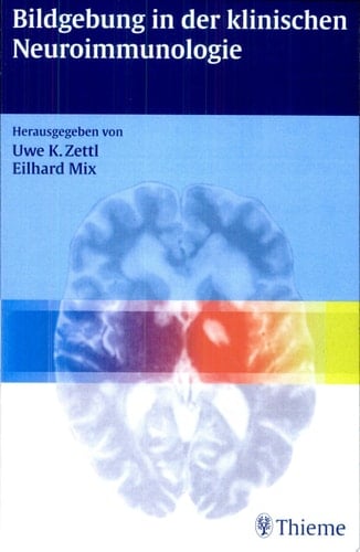 Bildgebung in der klinischen Neuroimmunologie