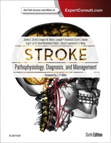 Stroke E-Book Pathophysiology, Diagnosis, and Management