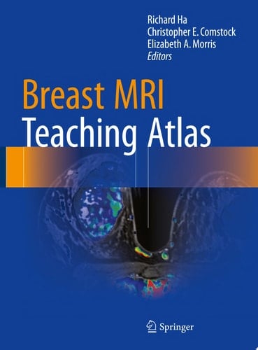 Breast MRI Teaching Atlas