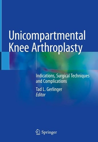 Unicompartmental Knee Arthroplasty Indications, Surgical Techniques and Complications