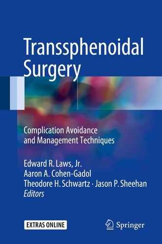 Transsphenoidal Surgery Complication Avoidance and Management Techniques