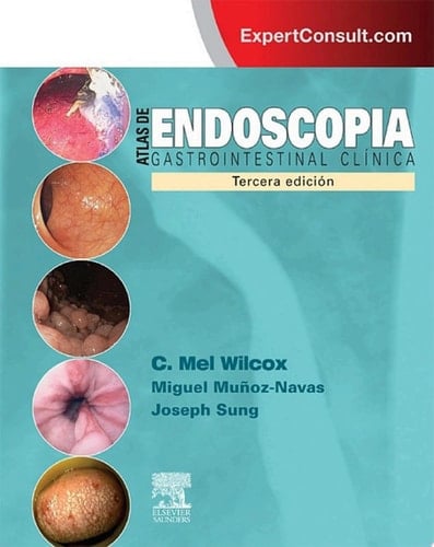 Atlas de endoscopia gastrointestinal clínica + ExpertConsult