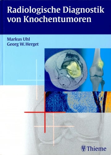 Radiologische Diagnostik von Knochentumoren 9 Tabellen