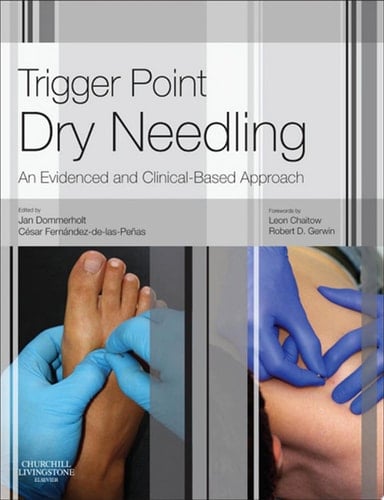 Trigger Point Dry Needling An Evidence and Clinical-Based Approach