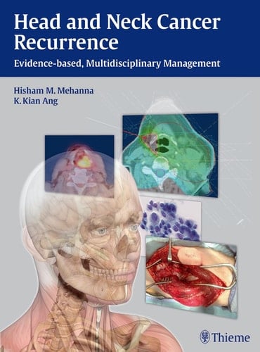 Head and Neck Cancer Recurrence Evidence-based, Multidisciplinary Management