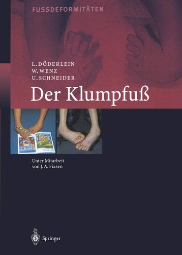 Der Klumpfuss Erscheinungsformen und Behandlungsprinzipien jeden Alters. Differentialdiagnose und Differentialtherapie
