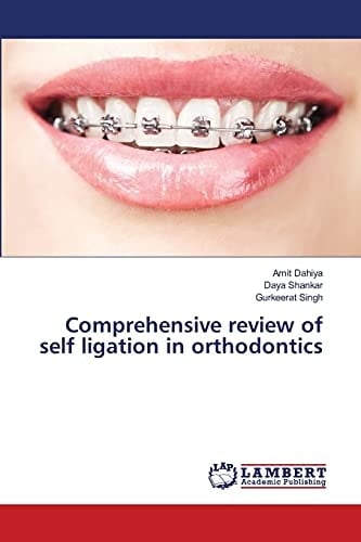 Comprehensive Review of Self Ligation in Orthodontics