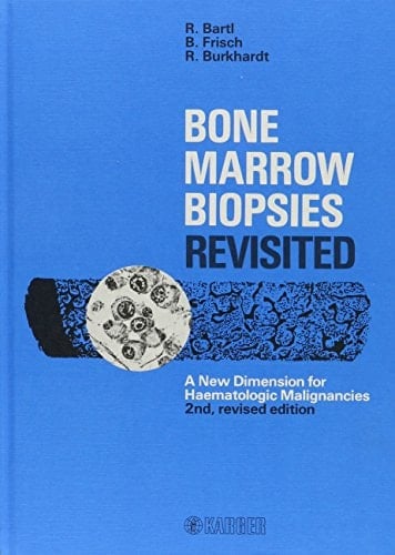Bone Marrow Biopsies Revisited: A New Dimension for Haematologic Malignancies