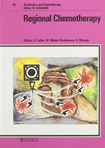 Regional Chemotherapy