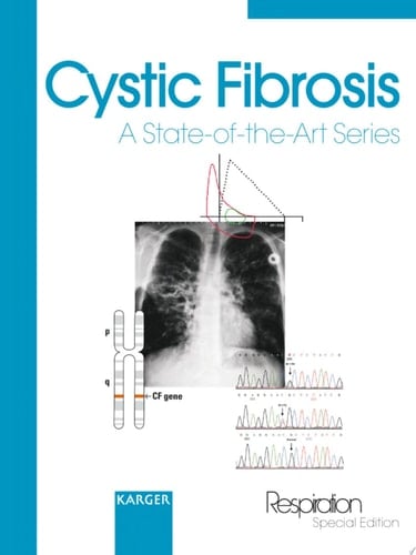 Cystic Fibrosis A State-of-the-Art Series