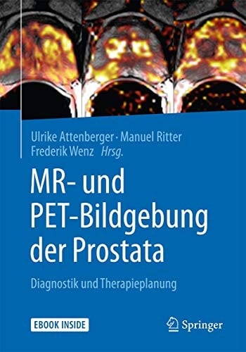 MR- und PET-Bildgebung der Prostata Diagnostik und Therapieplanung