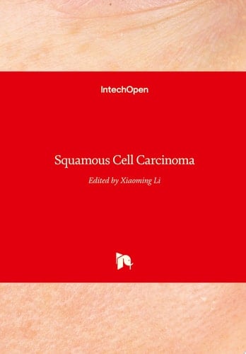 Squamous Cell Carcinoma