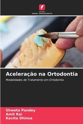 Aceleração na Ortodontia: Modalidades de Tratamento em Ortodontia (Portuguese Edition)