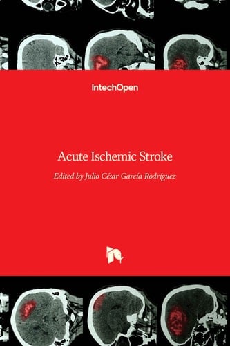 Acute Ischemic Stroke