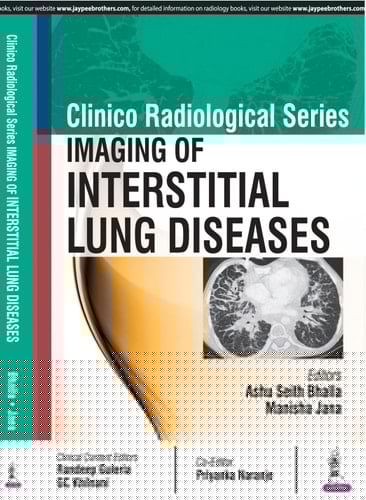 Clinico Radiological Series: Imaging of Interstitial Lung Diseases