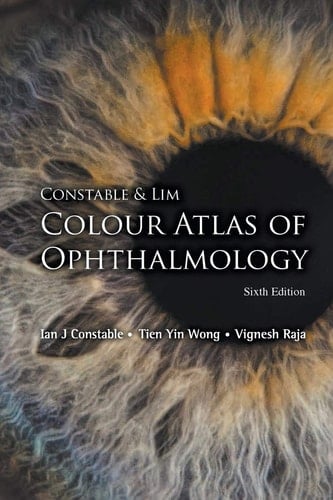Colour Atlas of Ophthalmology