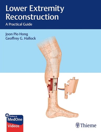 Lower Extremity Reconstruction A Practical Guide