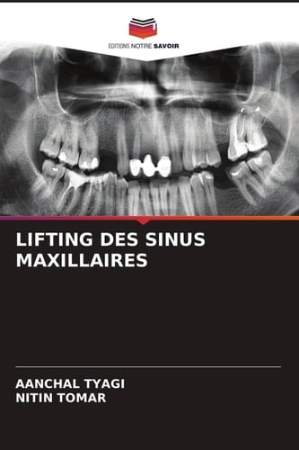 LIFTING DES SINUS MAXILLAIRES (French Edition)