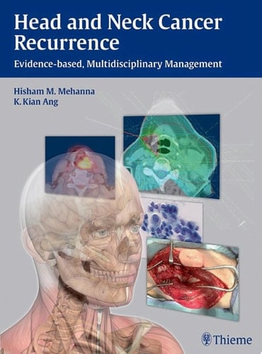 Head and Neck Cancer Recurrence Evidence-based, Multidisciplinary Management