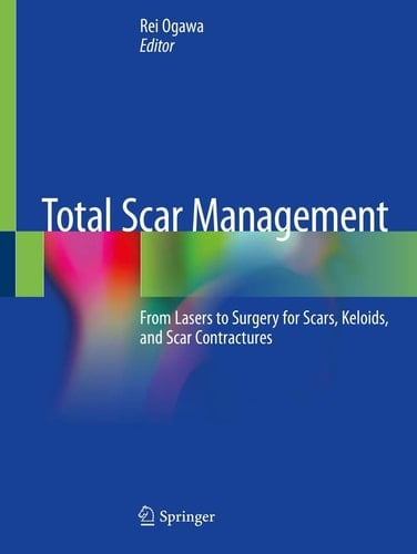 Total Scar Management From Lasers to Surgery for Scars, Keloids, and Scar Contractures