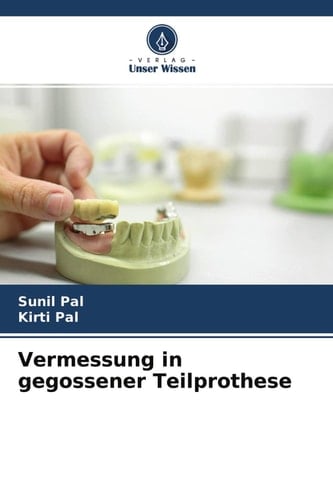 Vermessung in gegossener Teilprothese (German Edition)