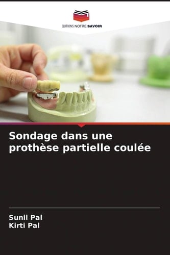Sondage dans une prothèse partielle coulée (French Edition)