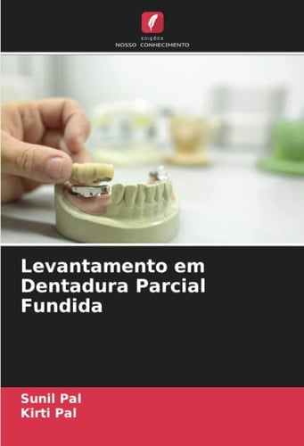Levantamento em Dentadura Parcial Fundida (Portuguese Edition)