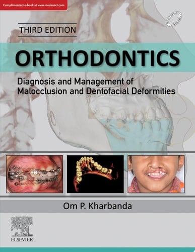 Orthodontics: Diagnosis and Management of Malocclusion and Dentofacial Deformities