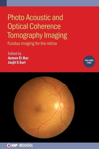 Photo Acoustic Optical Coherence Tomography Imaging Fundus Imaging for the Retina
