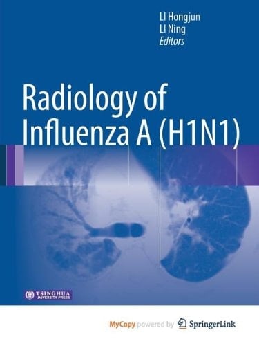Radiology of Influenza A (H1N1)