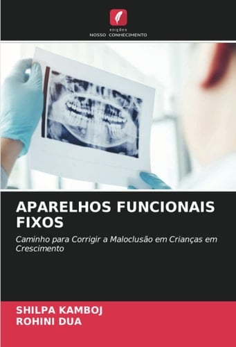APARELHOS FUNCIONAIS FIXOS: Caminho para Corrigir a Maloclusão em Crianças em Crescimento (Portuguese Edition)