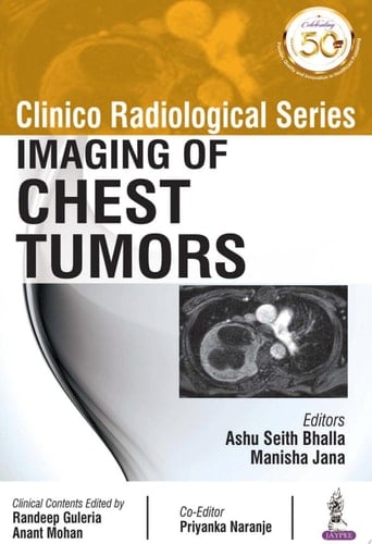 Clinico Radiological Series: Imaging of Chest Tumors